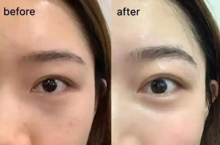 入冬后,很多人的皮肤都会干燥起皮